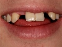 Konig Center for Cosmetic & Comprehensive Dentistry smile photos